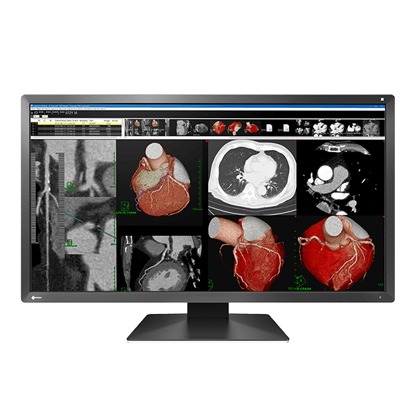 EIZO Eizo MX317 Colour DICOM LCD Monitor 31"" 8.8MP # 507710