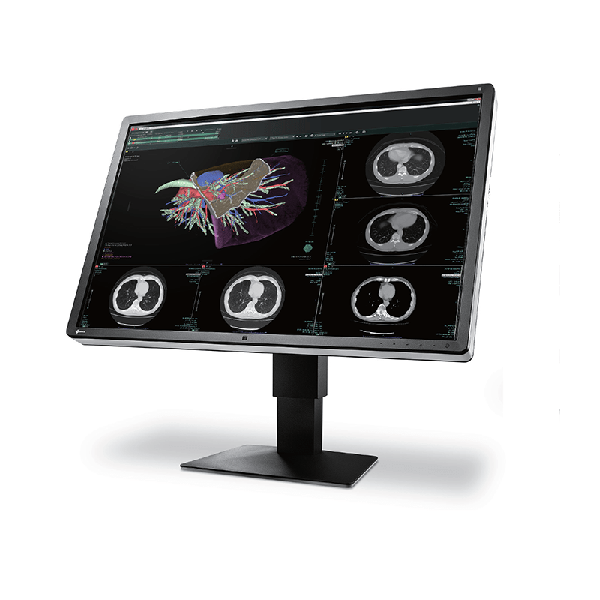 Eizo RX660 Colour Diagnostic LCD Monitor 30"" 3MP # EIZO — view 2