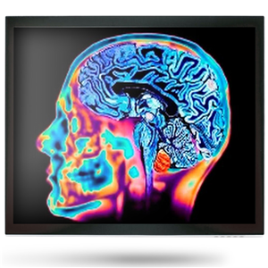 Onyx MEDDP-415HNN 15" Medical Display Onyx — view 2